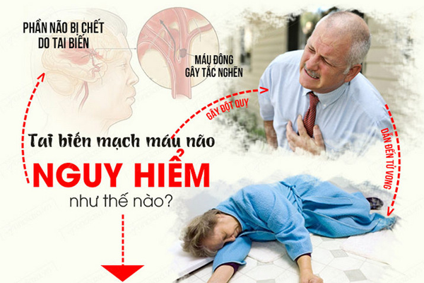 /uploads/1567604958-vat-ly-tri-lieu-sau-di-chung-tai-bien-mach-mau-nao-03.png