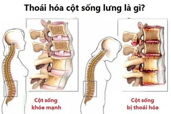/uploads/1571327207-thoai-hoa-cot-song-lung-01.png