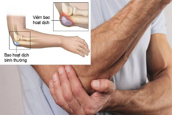 /uploads/1579271525-viem-bao-hoat-dich-01.png