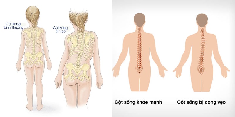/uploads/1747702420-cot-song-khong-binh-thuong.jpg